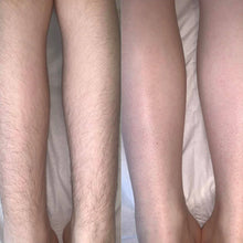 Load image into Gallery viewer, 03_Testimonial_IPL (1).webp__PID:28c11bd2-8c62-4a7c-891e-2bb37086b510
