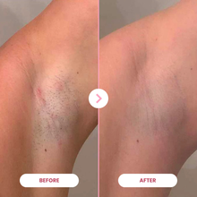 Load image into Gallery viewer, EpiLuxe
